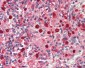 MPO / Myeloperoxidase Antibody
